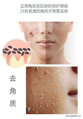 后天鸡皮肤怎么形成的