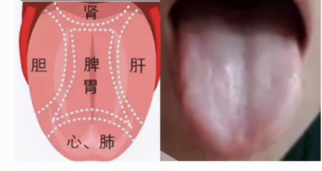 中医教你看舌诊，这几种情况要注意