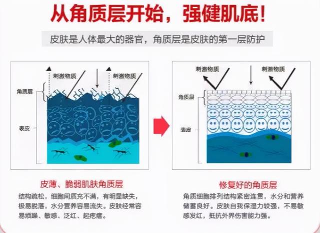 红血丝怎么去除最有效（去脸部红血丝的方法）