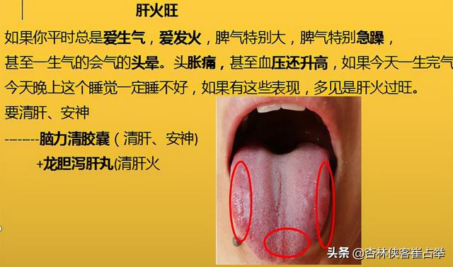 治疗失眠的中成药大总结，失眠、多梦、入睡困难再也不怕用错药