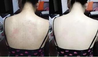 手工皂洗鸡皮肤