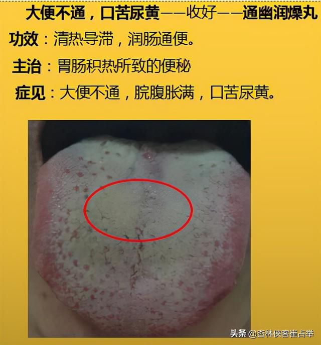 咽炎、高脂血症，四肢麻木，10个中成药，年过35岁后要收藏备好