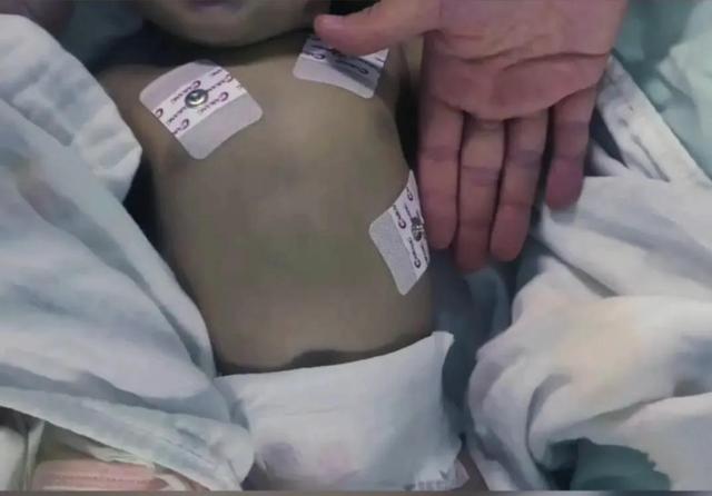 家长用熬煮的蔬菜水冲奶粉导致新生儿中毒，值得家长深思