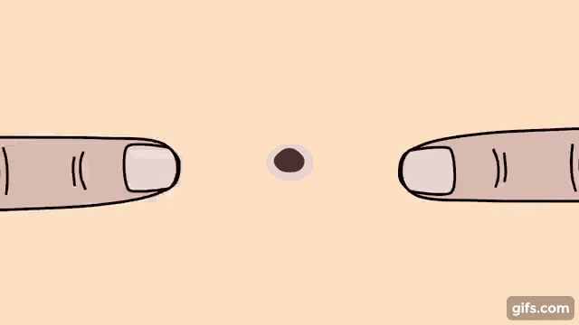 毛囊角化里面挤出来是白色的吗