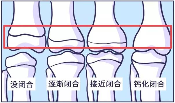 最佳儿童身高参照表，男孩女孩全都有，看看你家孩子合格没