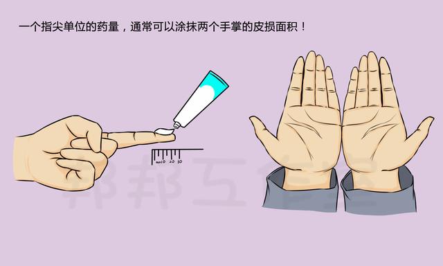 涂了身体乳可以涂炉甘石吗