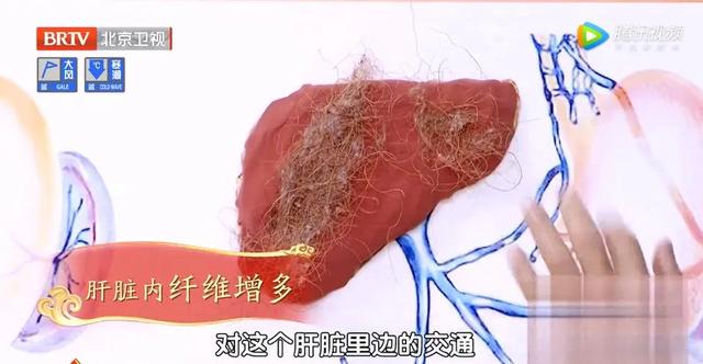 四个异常症状，是肝在求救！专家推荐一个饮食方法，帮您保肝护肝