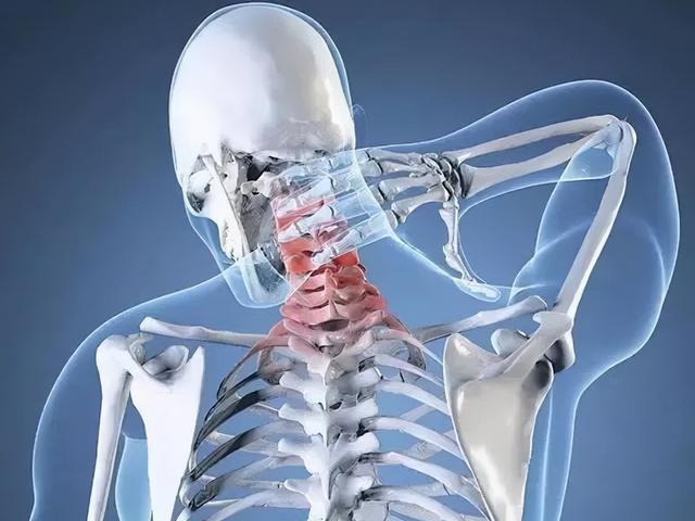 生命汇国际整合医疗｜病在颈椎，伤在全身