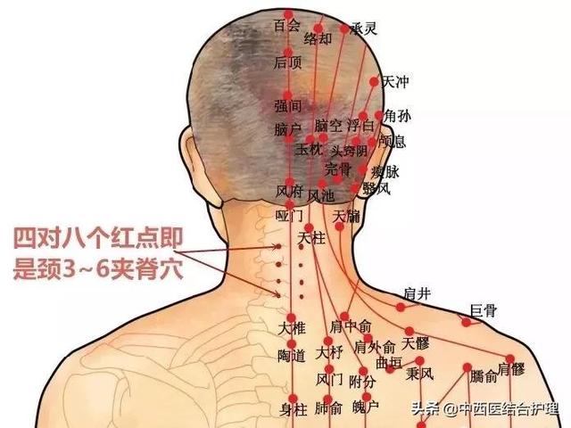 「经络养生」颈肩久治不断根，是这里“寒气”没有化解