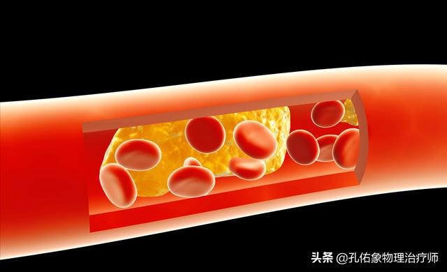 运动是一把双刃剑！老年人对抗衰老，要注意啥？告诉您几个建议