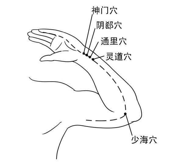 被人们忽略的中风先兆