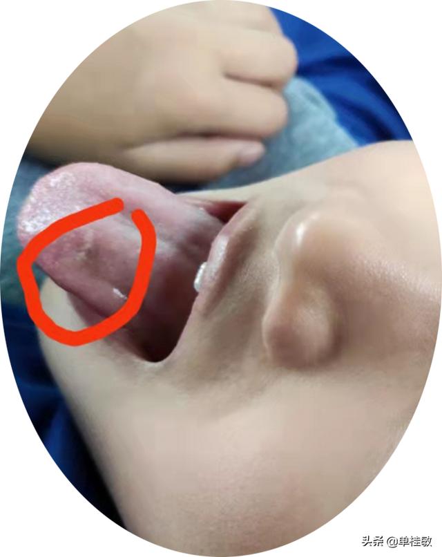 家里应该备一些内病外治艾灸产品以备急需