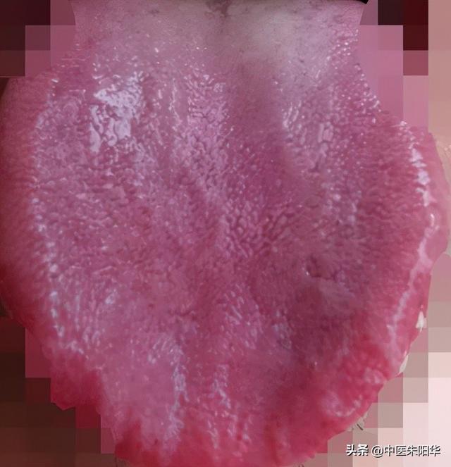对镜查舌早知病！中医教您如何通过舌头快速识别疾病