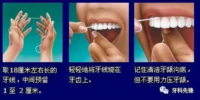 牙线怎么用（塑料牙线怎么用）