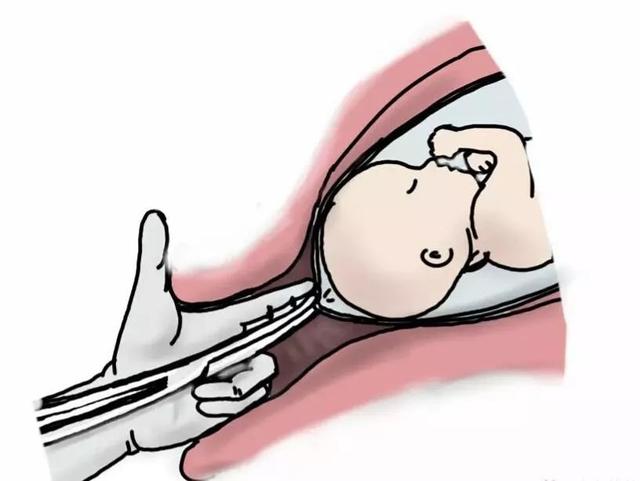 生娃的痛，只有经历过才知道