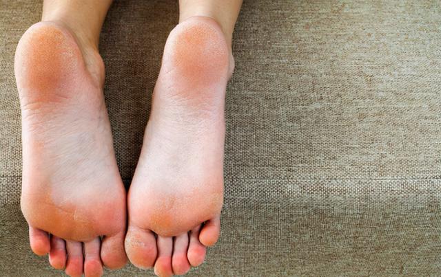 女性想知道自己是否健康，低头看看脚就知道，如有4个现象要留心
