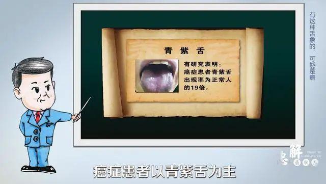 醫生提醒：癌變前，耳朵舌頭會“求救”！厚白苔肺癌，肝癭線肝癌