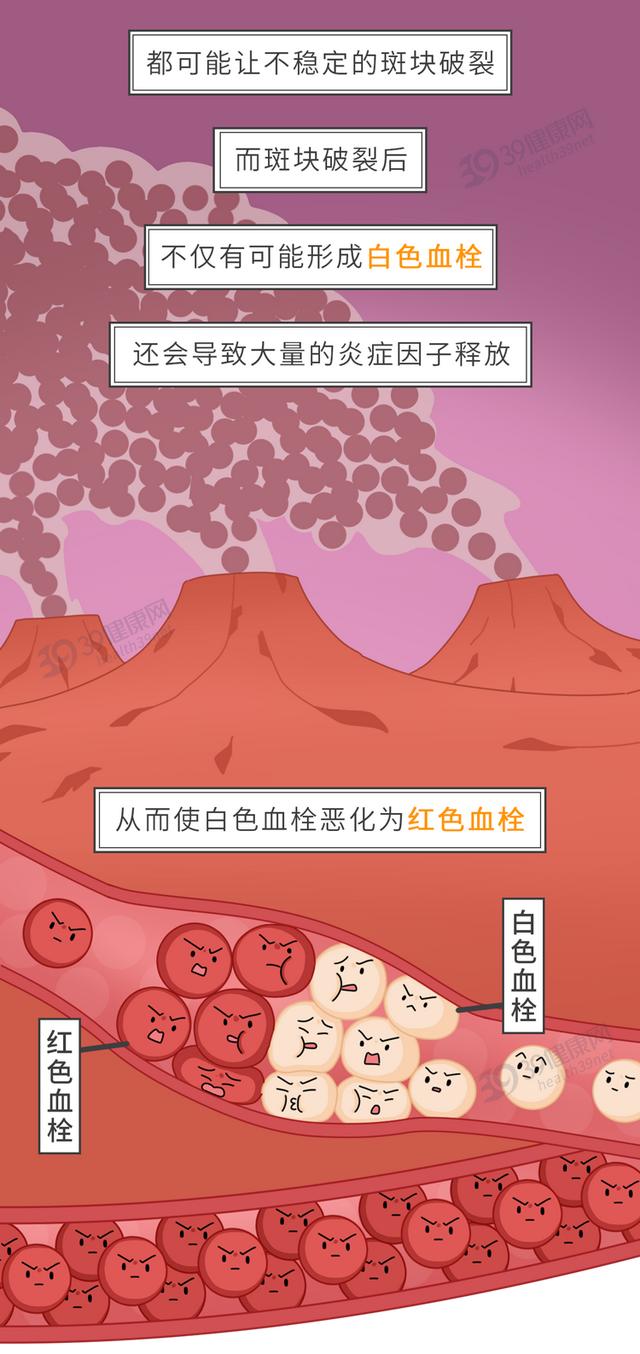 每年1790万人死于心血管疾病，这4类人群需提高警惕，降低血脂