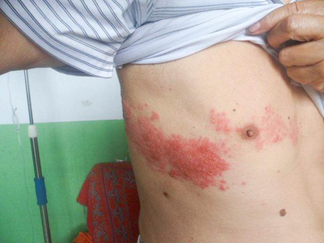 左侧肋骨下方疼痛是什么原因(左侧肋骨下方疼痛怎么缓解)-我的快乐