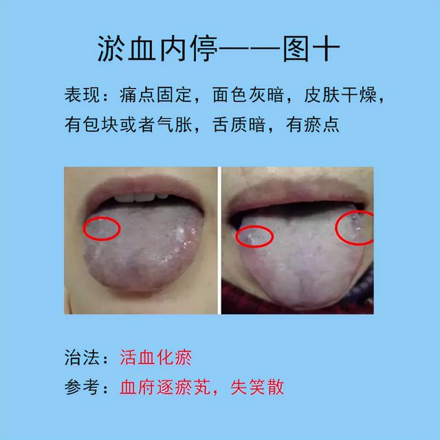脾胃常见的10种舌象，以及临床表现，后面带解决方法
