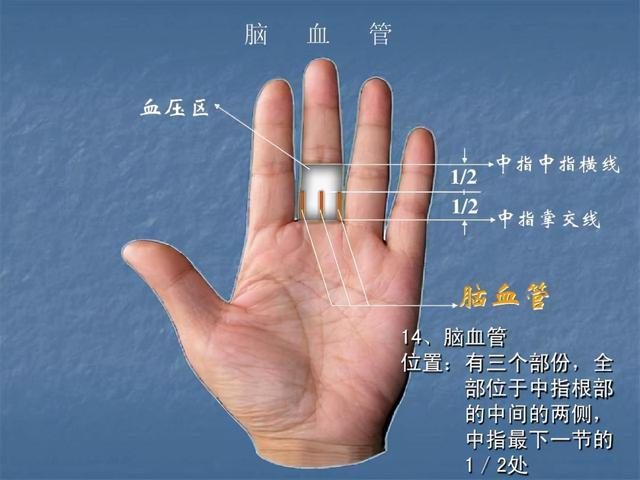 冬季脑血管病高发，手上反射区加仲景一方，学会可以预防脑血管病