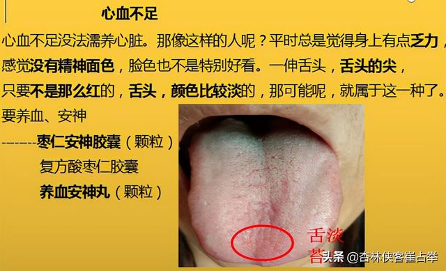 治疗失眠的中成药大总结，失眠、多梦、入睡困难再也不怕用错药