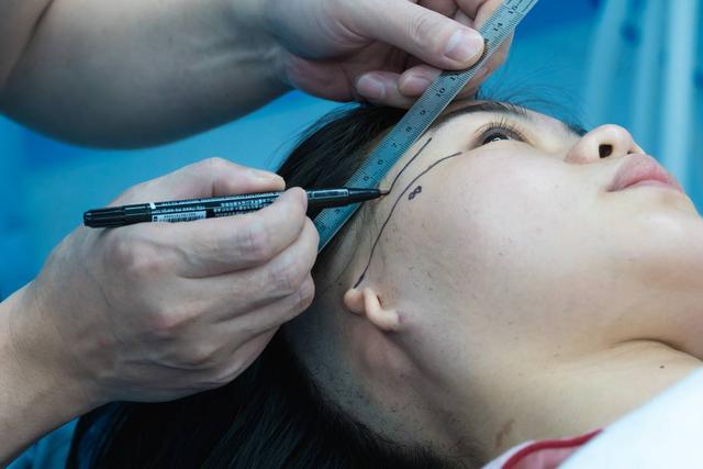 小孩耳朵畸形怎么办？小耳畸形手术后照片