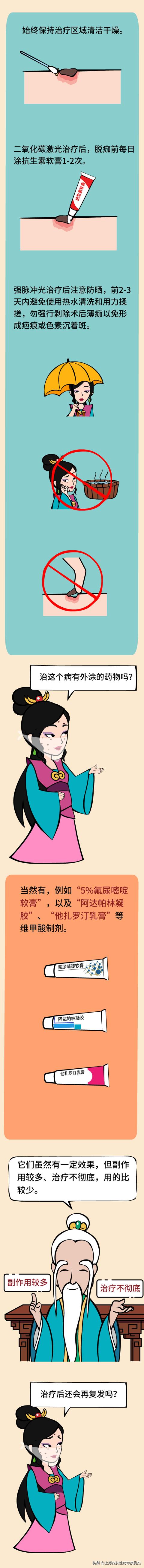 脂溢性角化症病例