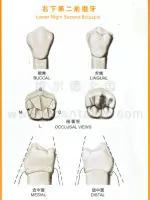 口腔牙齿图片大全图解