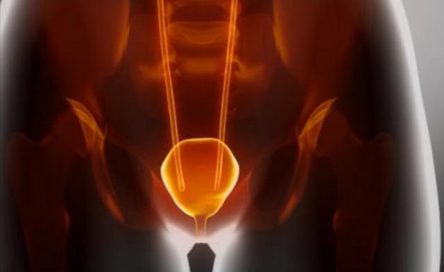 一喝水就尿多，代表肾脏好还是不好？看完这4点，你或许就明白了