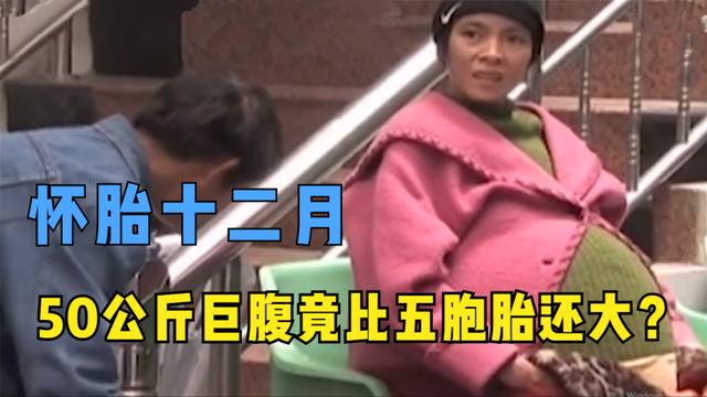 女子怀胎十二月，50公斤巨腹比五胞胎还要大，却迟迟未能生产
