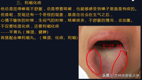 咳白痰、黄痰、清稀泡沫痰，3种情况3种原因，教你一分钟辨别