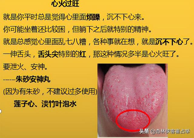 治疗失眠的中成药大总结，失眠、多梦、入睡困难再也不怕用错药