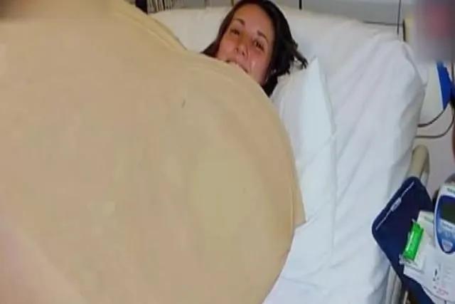 孕妈怀胎12个月，肚子大如气球，小宝宝出生后，吓坏医生和护士