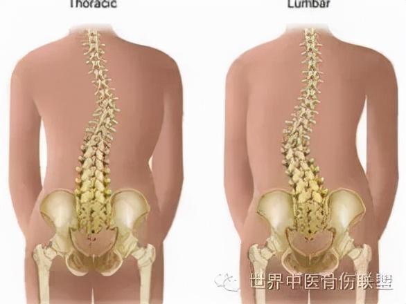 青少年预防颈椎病的四个要点