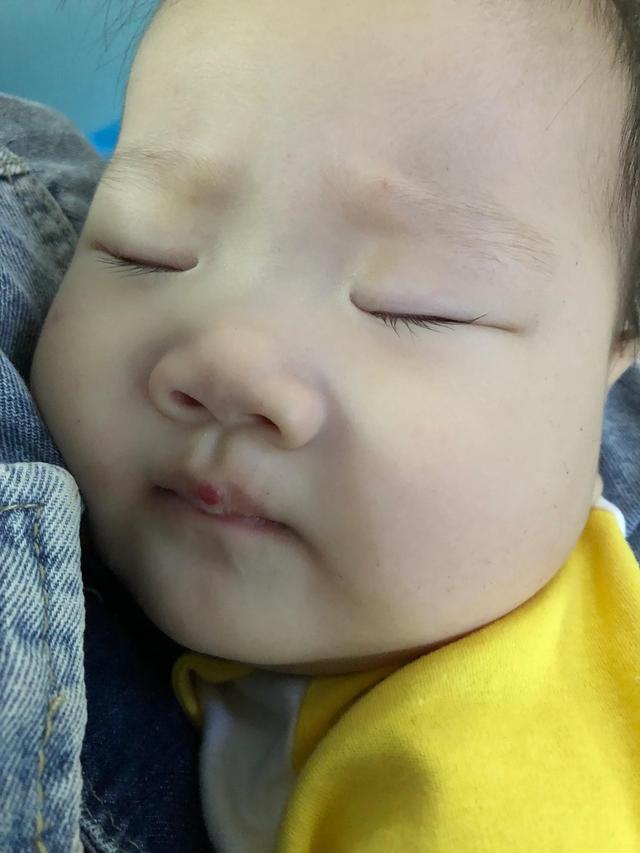 宝宝发烧怎么办？新手爸妈赶紧看