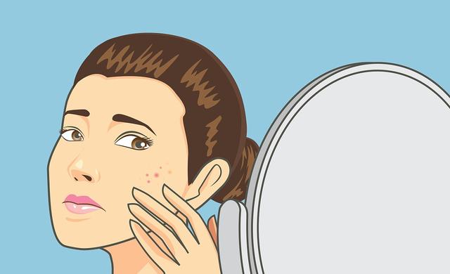 艾滋病三周皮肤角化严重