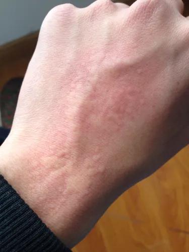 白领一族常见亚健康