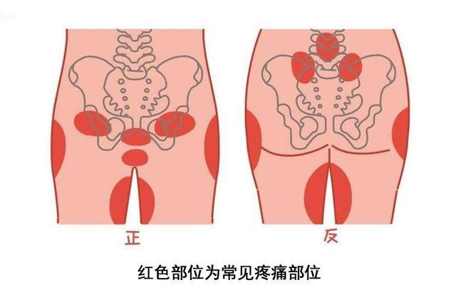 耻骨痛到底是哪里痛?孕期有四类孕妇容易被它"找上门"