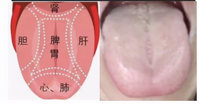 中医教你看舌诊，这几种情况要注意