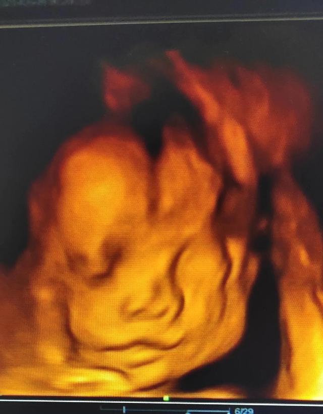 孕晚期那些事儿