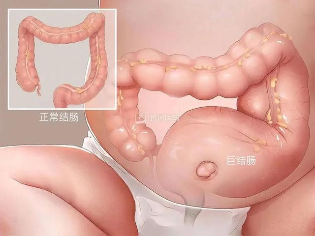 孩子喊肚子疼切勿轻视，当心小病拖成大病