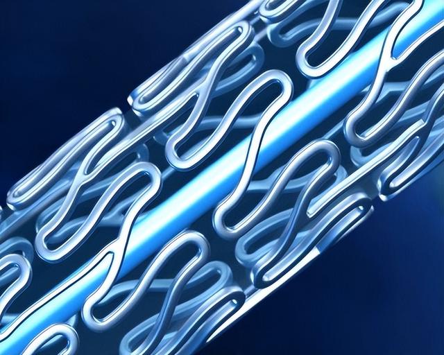 STENTiT完成180万欧元种子轮融资，促进再生支架的开发和量产