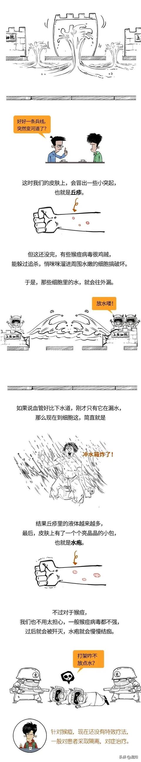 猴痘病毒扩散15个国家，有多可怕？来看看它怎么从里到外伤害你