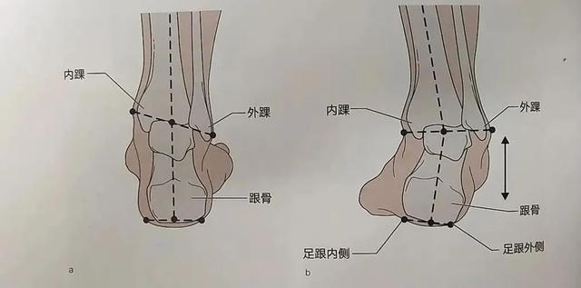 这8种凉鞋千万别给孩子穿！伤了骨头后悔就晚了