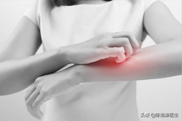 硫磺乳涂了4天身体还痒