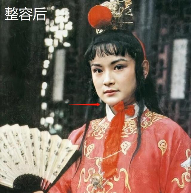 明星频翻车医美需谨慎！有人脸变充气气球，有人下巴变天气预报