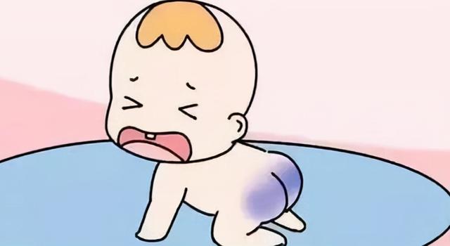 新生儿屁股有“淤青”是怎么回事？不是投胎时被踢，或与爸妈有关