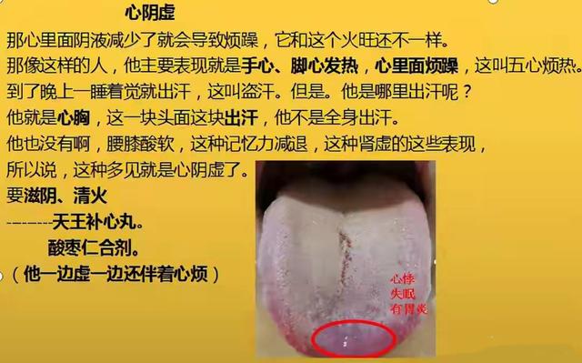 凌晨1—3点早醒，8种常见失眠类型，症状表现及实用中成药大总结