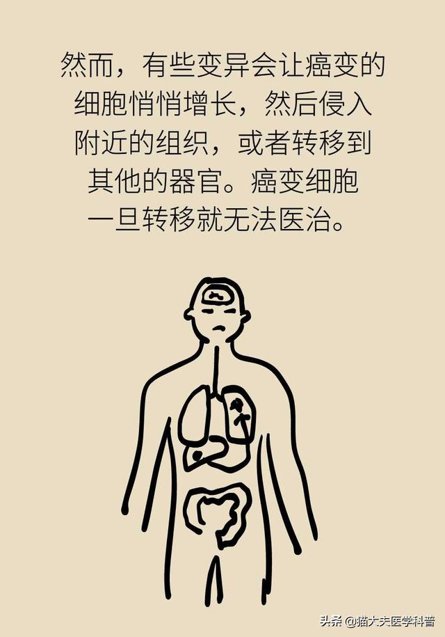 谈癌变色，这些治疗方法能够杀死癌细胞吗？